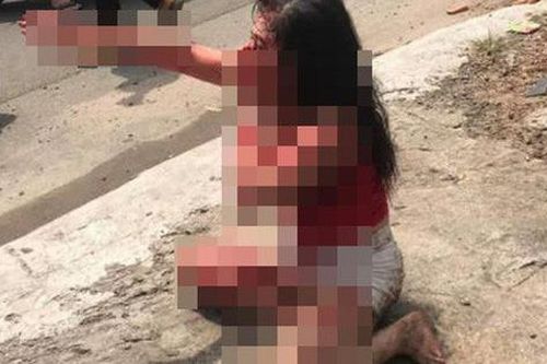 Phẫn nộ: Cô gái bị người tình cũ rạch mặt tàn ác
