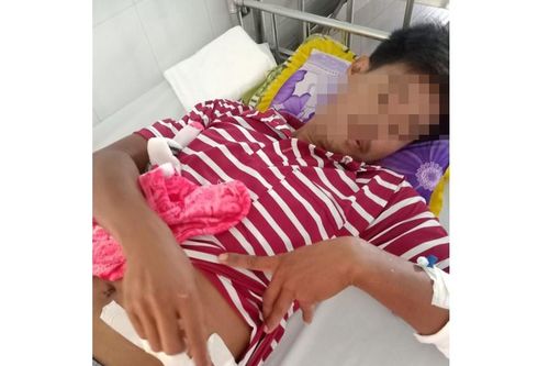 Dùng xung điện bắt cá, nam thanh niên bị thương do súng công an xã 'cướp cò'?