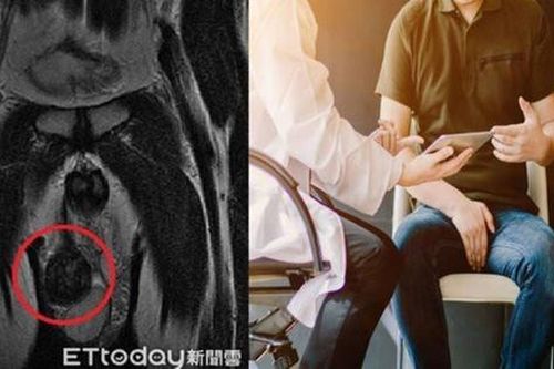 Phát hiện bạn trai có tới 3 tinh hoàn trong lúc âu yếm, cô gái ngã ngửa khi biết sự thật