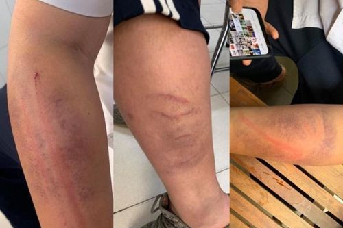 Dân mạng bức xúc với ông bố đánh con như kẻ thù vì 'chữ xấu'
