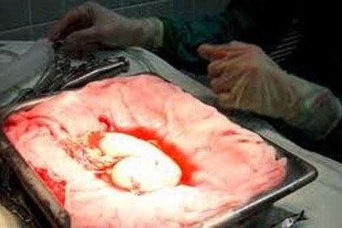 Hà Nội: 'Ông trùm' môi giới mua bán thận bị đề nghị truy tố