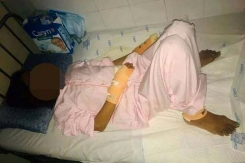Chính trị - Xã hội Pháp luật - Cuộc sống Chồng đổ xăng tự thiêu, vợ xông vào cứu khiến cả hai bỏng nặng