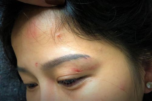 Cựu cán bộ công an đánh vợ cũ bị tạm giữ hình sự