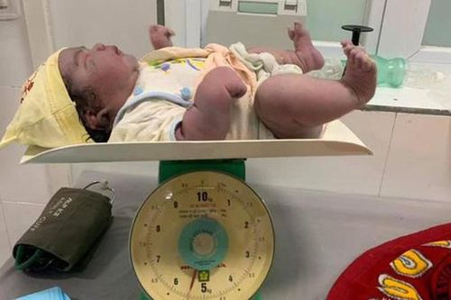 Kỳ tích sản phụ 'vượt cạn' sinh thường bé gái nặng 5,5kg