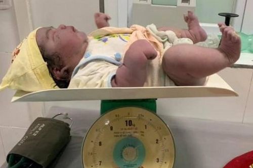 Bé nặng 5,5kg chào đời bằng phương pháp sinh thường