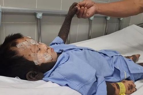 Điều kì diệu đến với cậu bé có 'làn da chó'