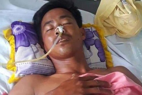 Tạm đình chỉ trưởng công an xã nổ súng làm thủng bụng người bắt chuột