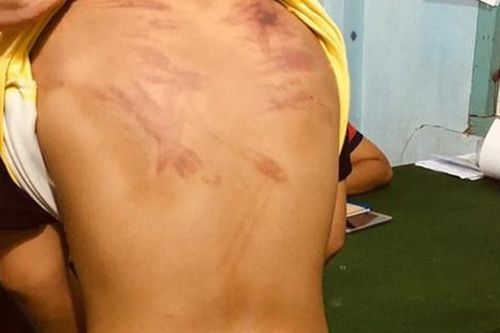 Đề nghị truy tố 'thầy tu' bạo hành trẻ em tại khóa tu mùa hè trái phép