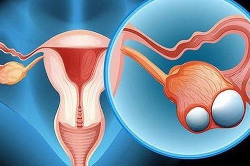 Cô gái 23 tuổi chưa kết hôn đã bị ung thư dạ dày di căn buồng trứng, cảnh báo những thói quen xấu nhiều người mắc