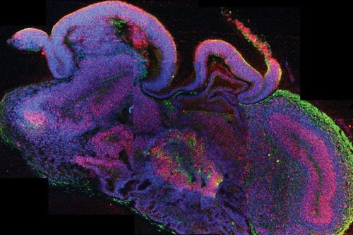 Tạo ra não người, khoa học đang 'đi quá giới hạn'?