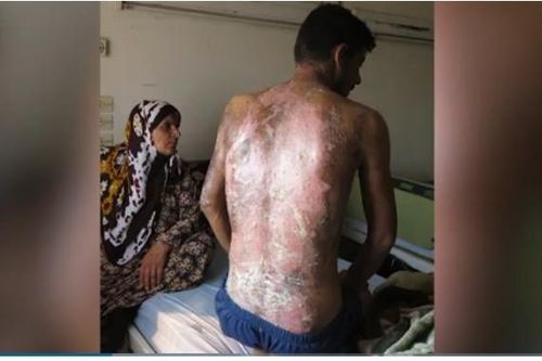 Thổ Nhĩ Kỳ sử dụng vũ khí hóa học chống lại người Kurd ở Syria?
