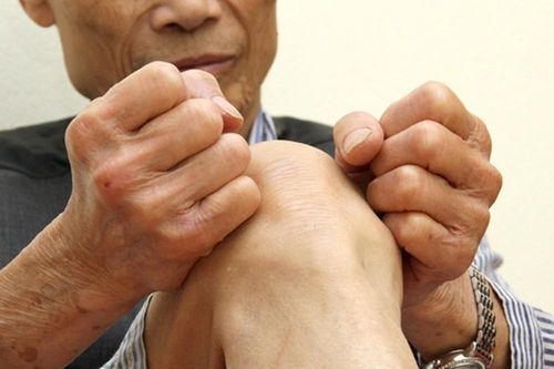 Chuyên gia Pháp khám và tư vấn miễn phí cho bệnh nhân khớp gối