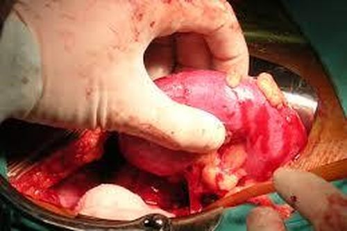 Truy tố đối tượng nhiều lần môi giới mua bán bộ phận cơ thể người