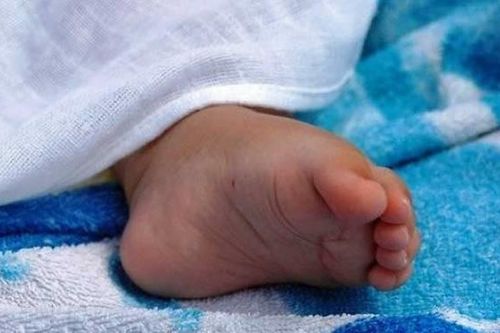 Em bé sinh ra không có mặt, bác sĩ bị đình chỉ ở Bồ Đào Nha