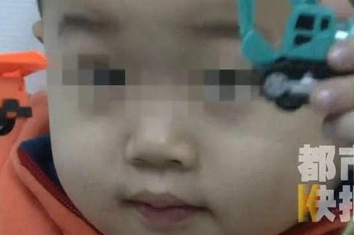 Bé trai 3 tuổi bị mù suốt 10 ngày chỉ vì bị cảm lạnh nhưng không điều trị dứt điểm