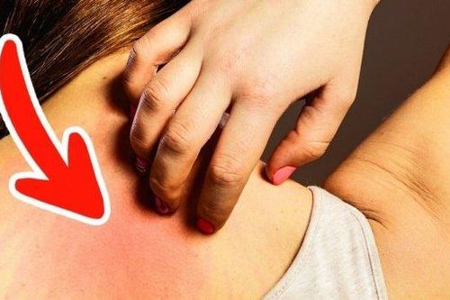 7 dấu hiệu cảnh báo ung thư sớm, 90% mọi người thường bỏ qua