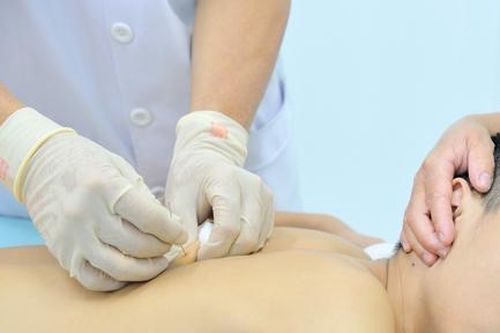 Điều trị chứng tự kỷ bằng phương pháp kết hợp đông tây y