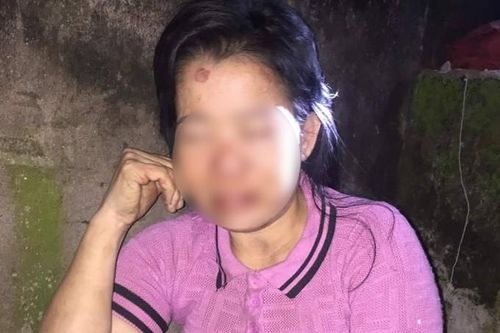 Làm rõ nghi vấn người phụ nữ bị hành hung dã man