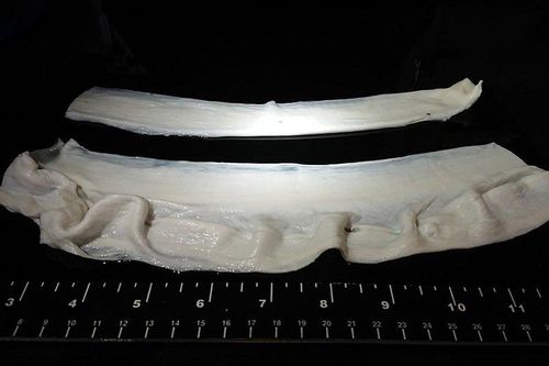 Dùng gelatin làm 'giàn giáo' để tạo cơ cho thịt nhân tạo