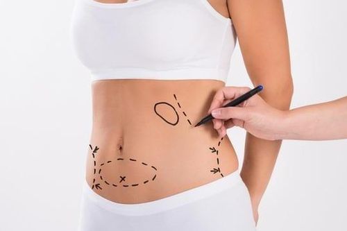 Bệnh viện thẩm mỹ ở TP.HCM bị tố hút mỡ bụng cho thai phụ