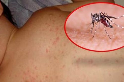Cả nước đã có 50 ca tử vong vì sốt xuất huyết từ đầu năm