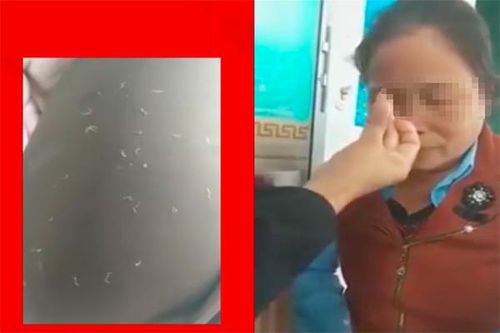 Video chữa bệnh kỳ quái, 'bắt sâu' trên mặt để chữa viêm xoang
