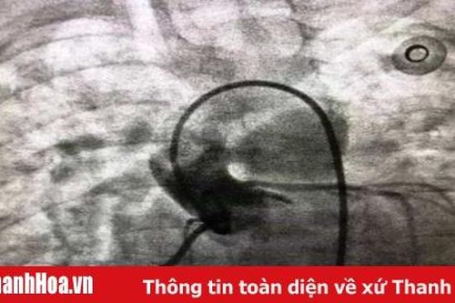 Bệnh viện Nhi Thanh Hóa: Can thiệp bít lỗ thông thành công cho cháu bé 13 tháng tuổi bị bệnh tim bẩm sinh