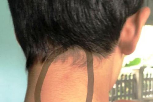 Nhóm phụ huynh tấn công nam sinh lớp 8 THCS Quảng Ninh: côn đồ... xử thế nào?