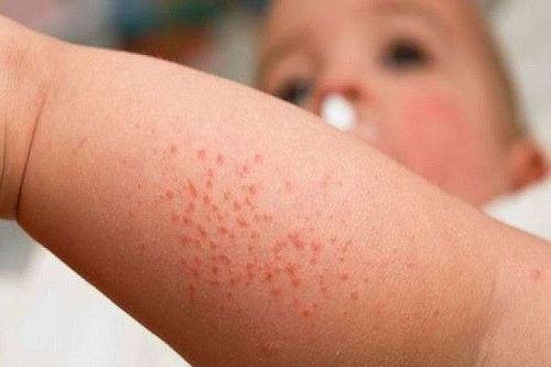 Những bệnh 'chết nhanh không ngờ' có thể mắc khi thời tiết giao mùa