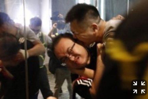 Nghị sĩ Hong Kong bị tấn công, cắn đứt tai giữa cuộc biểu tình