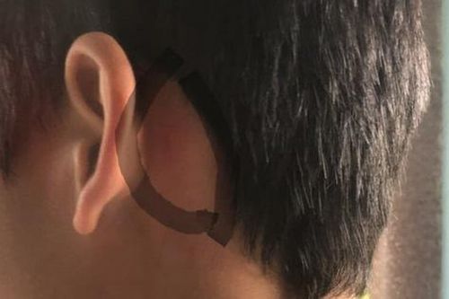 Thanh Hóa: Giấu dép của bạn, nam sinh lớp 8 bị nhóm phụ huynh hành hung tại trường học