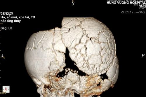 Trẻ bị chứng bệnh cực hiếm, 1 triệu ca sinh mới có 1 trường hợp mắc