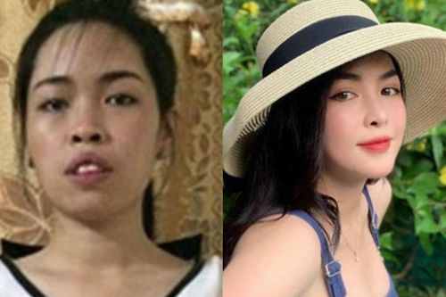'Giờ chỗ nào sửa cho đẹp thì khoe ra chứ tội gì giấu giếm'
