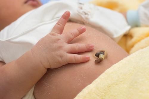 Cách nhận biết dấu hiệu nguy hiểm trên rốn trẻ sơ sinh