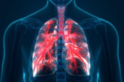 Triệu chứng và cách chữa bệnh phổi tắc nghẽn mãn tính