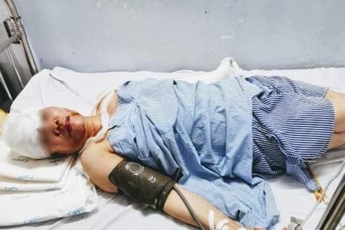 Hà Nội: Vờ bị truy sát, xông vào nhà nghỉ chém bà chủ