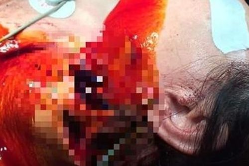 Dùng dao giết vợ rồi tự sát