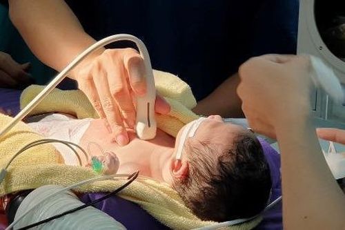 Cứu trẻ nguy kịch ngay sau sinh