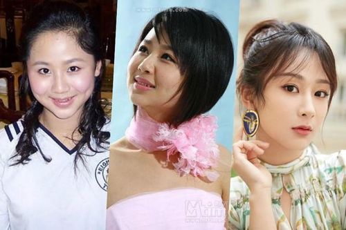 Dương Tử bị nghi phẫu thuật thẩm mỹ