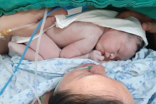 Bác sĩ vừa mổ đẻ vừa cắt u xơ tử cung