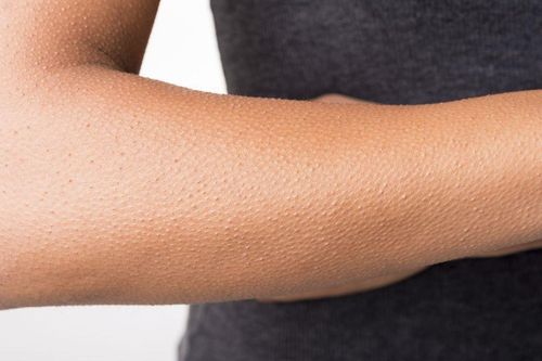 Giải mã hiện tượng nổi da gà