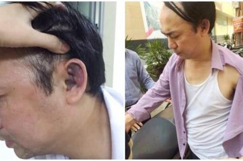 Cần sớm điều tra, xử lý nghiêm vụ cố ý gây thương tích ở Hà Đông