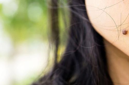 8 đặc điểm trên cơ thể tưởng vô dụng nhưng lại có ích