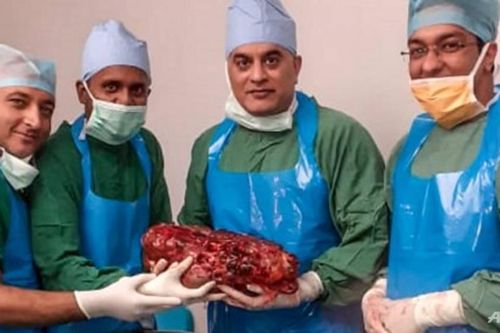 Bác sĩ Ấn Độ phẫu thuật cắt bỏ thận khổng lồ 7,4 kg khỏi bệnh nhân