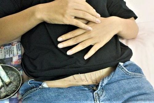 Xử lý cơ sở châm cứu hoạt động không phép tại TP.HCM