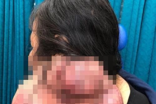 Người phụ nữ mắc khối u hiếm gặp, y văn thế giới chưa ghi nhận