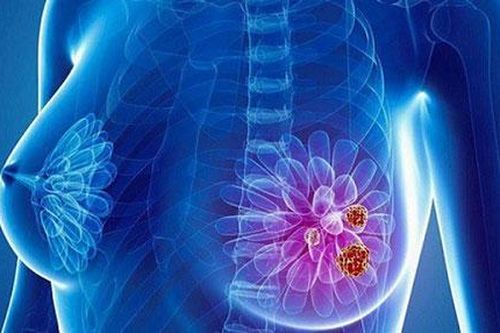 Tái sử dụng dầu rán nhiều lần gây ung thư vú di căn?