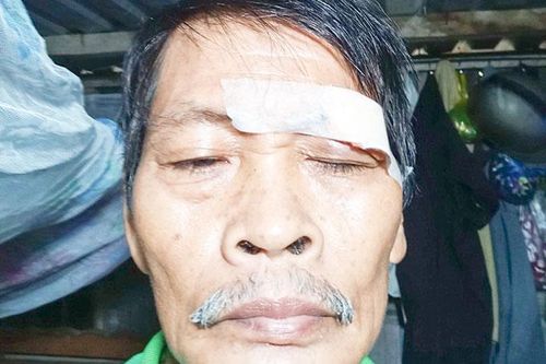 Một người dân vô cớ bị bắn
