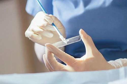 Hàng nghìn phụ nữ Việt mất mạng vì ung thư cổ tử cung, phát hiện bệnh bằng phương pháp nào?