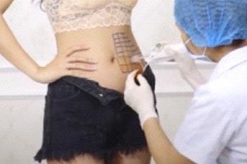 Giảm béo thần tốc và những chiêu 'bịp' khách hàng